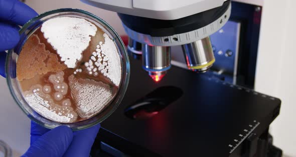 Petri dish with bacteria on the background of a microscope.