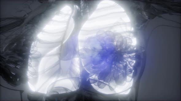 Human Lungs Radiology Exam alt