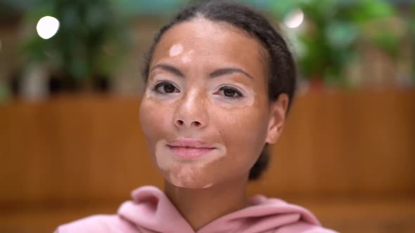 Black African American Woman with Vitiligo Pigmentation Skin Problem Indoor Dressed Pink Hoodie
