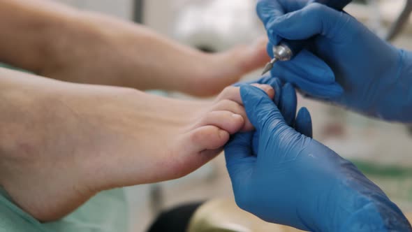 Professional Medical Pedicure Procedure