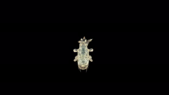 Predatory Mite Acari Order Mesostigmata Under a Microscope Possibly of the Ascidae Family