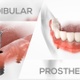 Mandibular Prosthesis - VideoHive Item for Sale
