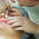 The Cosmetologist Makes Injections on the Client's Face in the Lip Area - VideoHive Item for Sale
