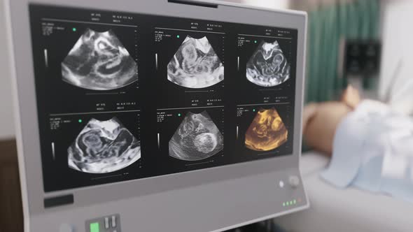 Hospital scanner carrying out a prenatal test to analyze the health of the baby alt
