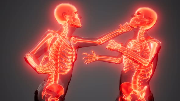 Fighting Men with Visible Bones alt