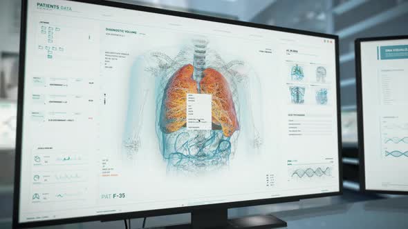 Working In Futuristic Medical Software To Analyze Lungs Affection For Report alt