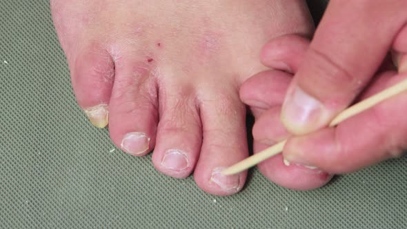 A Hand with an Orange Stick Gently Removes the Cuticle on the Toe