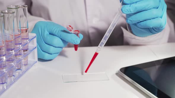 The Doctor Analyzes Blood Samples and Writes the Results To a Spreadsheet on the Tablet.