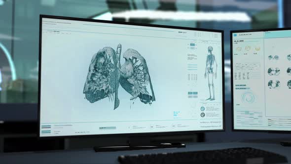 Patient Health Examination On Advanced X-ray Screening Software Interface alt
