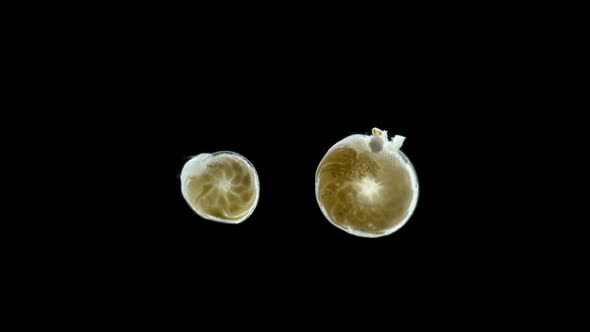 Foraminifera Under a Microscope Class Rotaliata Possibly Order Rotaliida