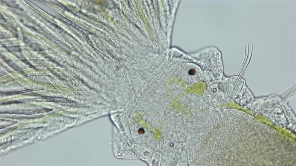 Polychaeta Worm Order Sabellida Under a Microscope