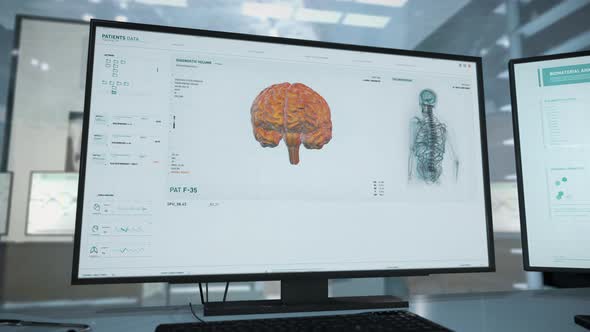 Patient Upper Body Data Scan Via Futuristic Medical Anatomy Scanning Equipment alt