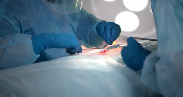 Doctor Holding Needle Holder Suturing the Wound in Operating Room
