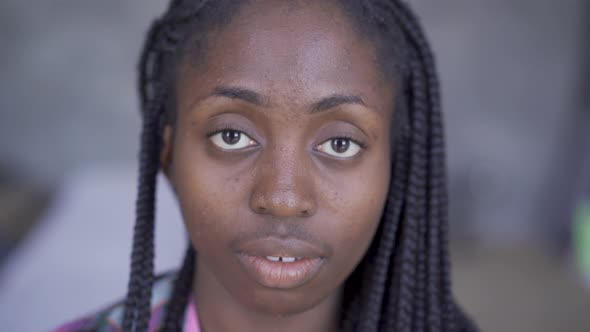 Close-up of Young African American Woman with Problem Skin Looking at Camera. Skincare Concept.