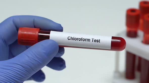 Chloroform Test, Doctor Holding Blood Sample in Tube Close-Up, Health Check-Up