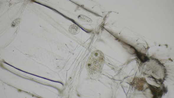 Paramecium Ciliates Under The Microscope