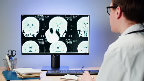 Doctor Examining Xray on Computer Monitor