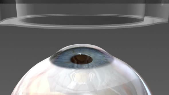 Anatomy of the eye. laser eye surgery