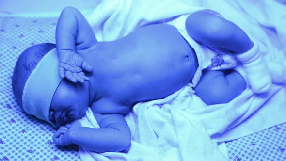 Newborn Having a Treatment for Jaundice Under Ultraviolet Lamp in Home Bed