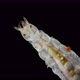 Larva Mite Hydrachnidia and Hydrophilidae Larva Under a Microscope - VideoHive Item for Sale
