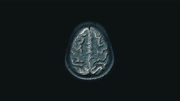 Bulk Multicolored MRI Brain, Head Scans and Tumor Detection, Diagnostic Medical Tool