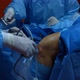 Knee Surgery, Arthroscopy - VideoHive Item for Sale