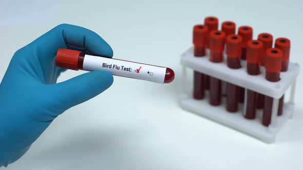 Negative Bird Flu Test, Doctor Showing Blood Sample, Lab Research, Healthcare