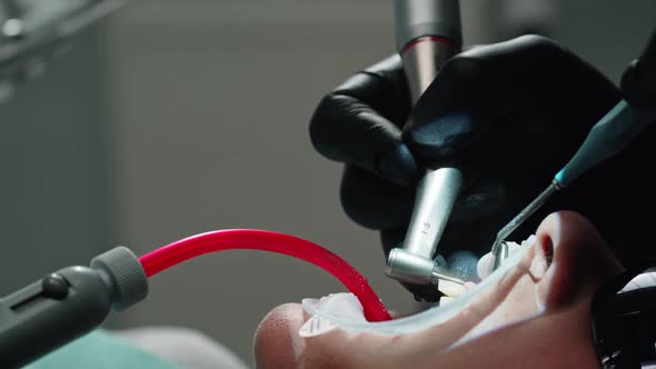 Dentist performs medical manipulations. Hands of dentist with surgical instrument