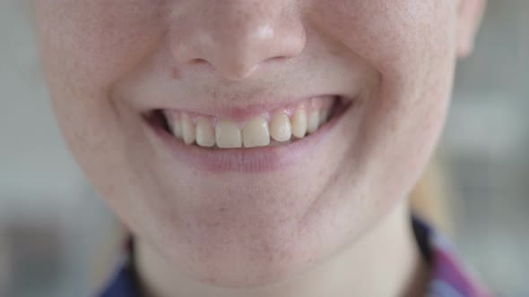 Close Up of Young Woman's Smile