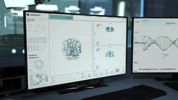 Interface of the modern medical system detecting brain tumors in the human head alt