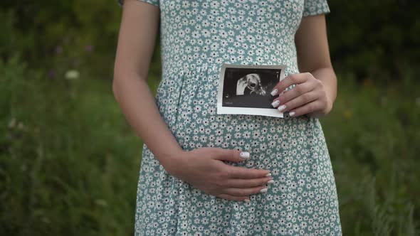 A Young Pregnant Woman Holds an Ultrasound Picture of a Baby in Her Hands