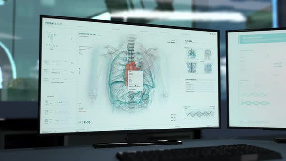 Modern Medical scanner identifies Cardiac Ischemia in the sick patients body alt