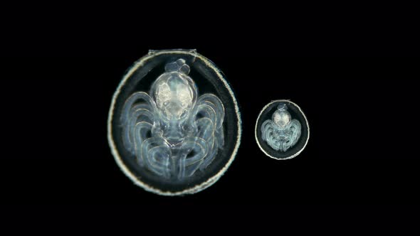 Placotrophic Juvenile Stage of the Linguliform Brachiopod Under a Microscope, a Type of the Oldest