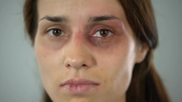 Hurt Lady Crying, Bruised Face Close-Up, Domestic Violence Issue, Awareness