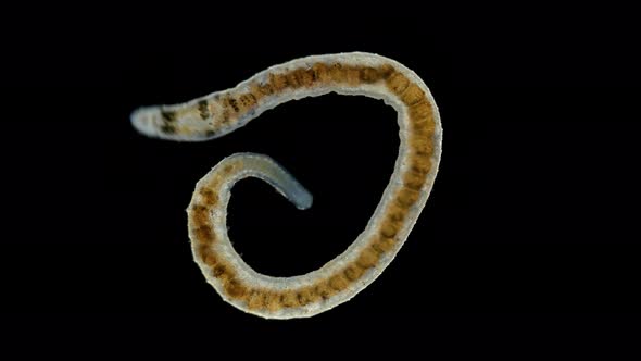 Ophidonais serpentina worm under a microscope, Oligochaeta Subclass