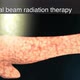 Radiotherapy is the treatment of cancer using ionizing radiation. - VideoHive Item for Sale