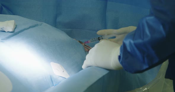 Surgeons preforming a cardiac catheterization in an operating room in a hospital