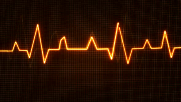 Medical pulse trace animation