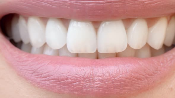 Smile of a Charming Girl with Perfect White Teeth Close Up. Perfect White Teeth and a Smile.