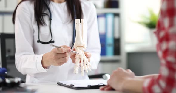 Doctor Shows Skeleton of Leg and Problem of Bones in Patient Closeup