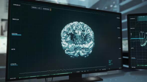 Skull X-Ray Scan In Newest Medical Software On Computer Screen At Laboratory