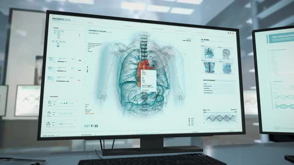 Innovative Hospital Computer Starts Health Diagnostic Of Human Heart Organ alt