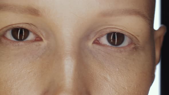 Close Up of Face of Young Hairless Woman with Brown Eyes