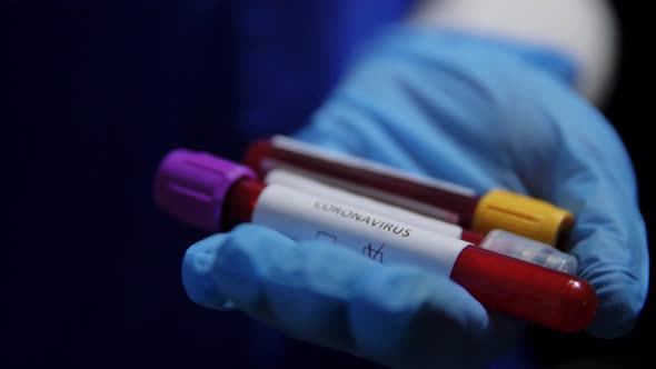 Hand Holding Beakers with Coronavirus Blood Test