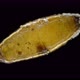 Colony Soil mites of the Acaridae family under a microscope. In an old cocoon of Lumbricidae worms - VideoHive Item for Sale