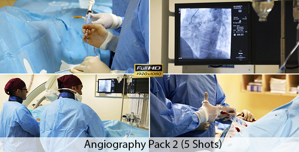 Angiography