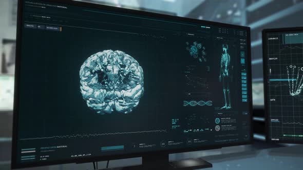 Patient Laboratory Examination Reveals Cancerous Brain Tumor Diagnosis alt