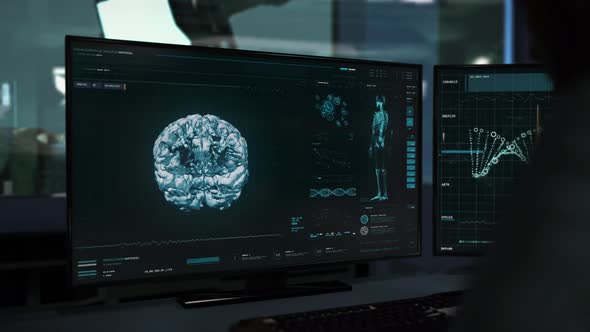 Advanced X-ray Scanner Equipment Interface Scans Human Head At A Medical Lab alt