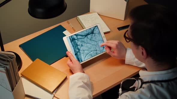 Doctor Examining Blood Vessels Xray on Gadget Tablet