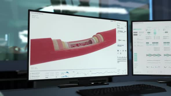 Health Examination System Scans Artery Of Patient To Check Blood Cells alt